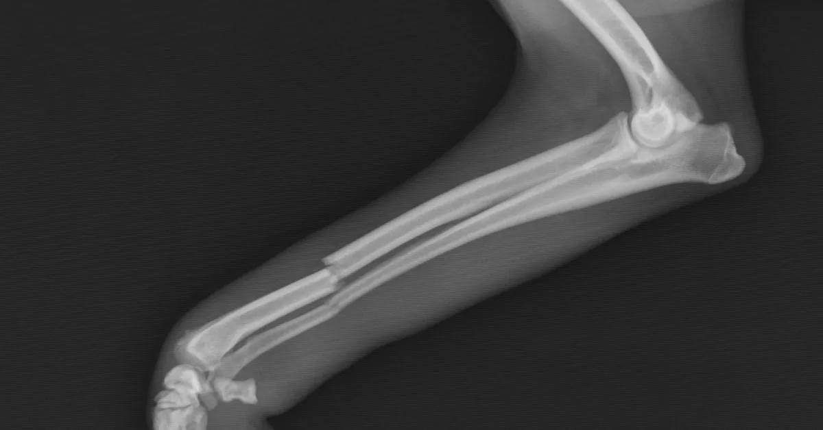 X-ray of a radius and ulna fracture in a dog's leg